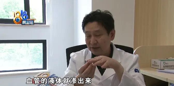 烫伤后不要过于紧张,烫伤后紧急处理