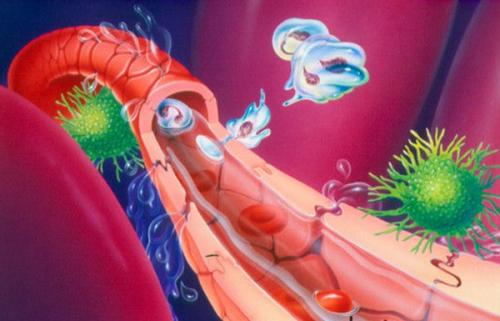 肛周脓肿健康宣教,肛周脓肿术后腹泻危害