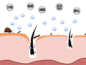 下巴挤出小米粒样的东西,下巴闭口挤出来的东西臭