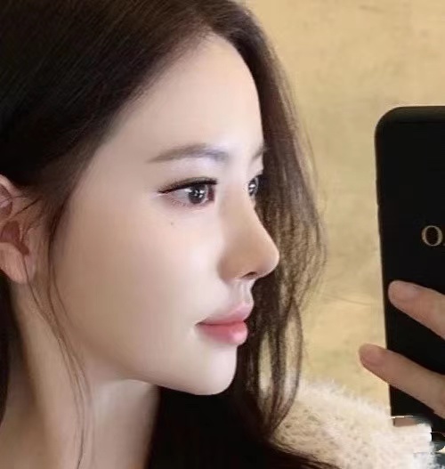 瘦鼻夹真的可以瘦鼻子吗,怎样瘦鼻子最快最有效的方法