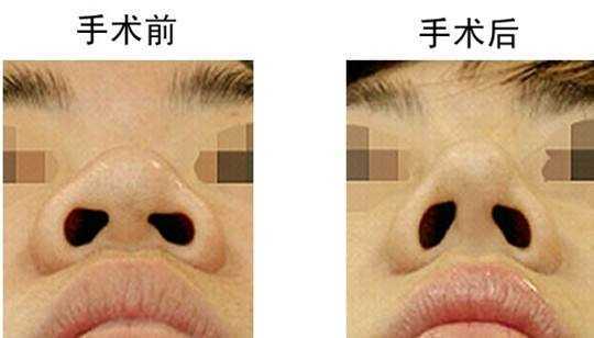 泰剧吹落的树叶主角变性,吹落的树叶泰剧女主变性前的样子