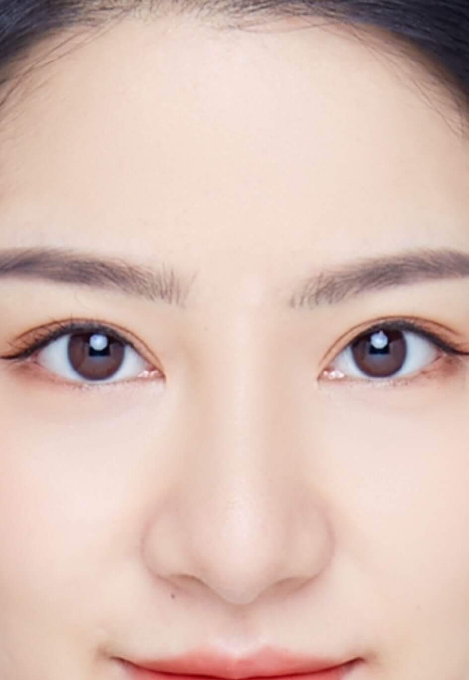 2022年新双眼皮手术多少钱一个月,医院双眼皮手术一次价格