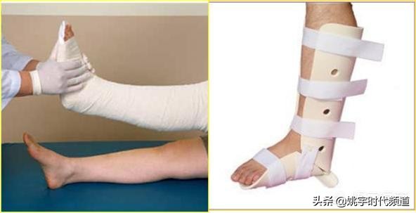 骨折做完手术注意哪些事项,骨折以后做手术以后需要注意什么