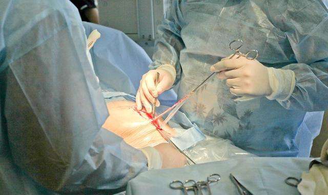 剖腹产用美容线好还是拆线比较好,剖腹产美容线和拆线的区别