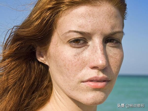 祛斑干货！内服、外调*管双**齐下，具体怎么做？