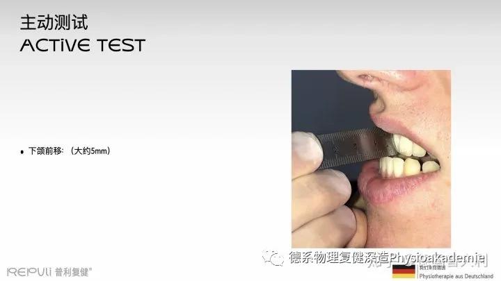 颞下颌关节紊乱综合征,颞下颌关节紊乱主要检查什么项目