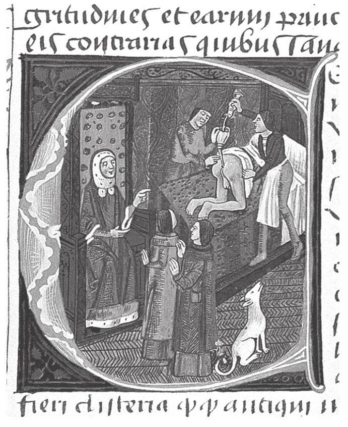 欧洲水蛭放血治疗,外国人用水蛭放在身上治病