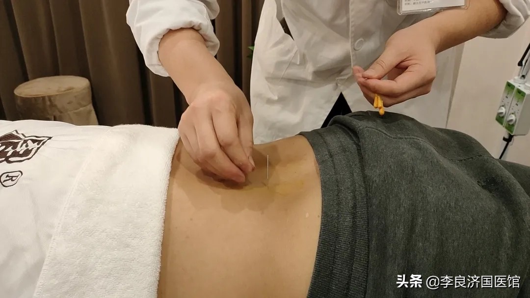 王欣君针灸,针灸推拿专家坐诊