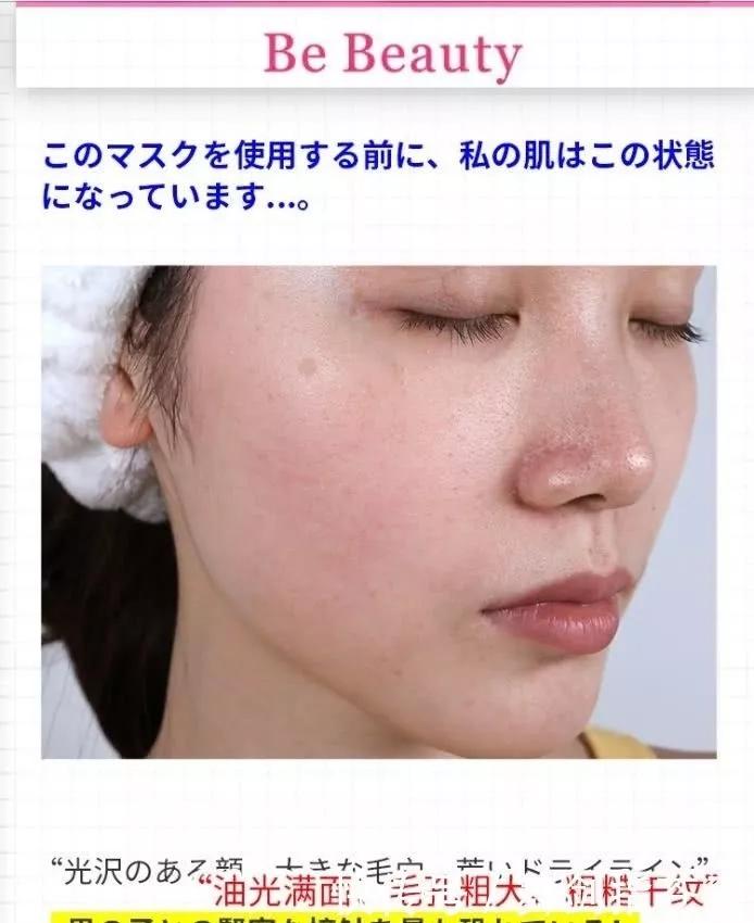 马应龙老干妈国货走出国门,国货老品牌痔疮膏