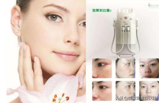 美容仪器和激光祛斑,美容仪器祛斑有效果吗
