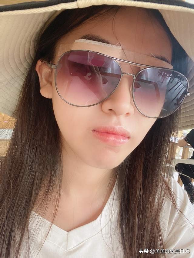 双眼皮知识点总结大全,关于双眼皮的十大真相