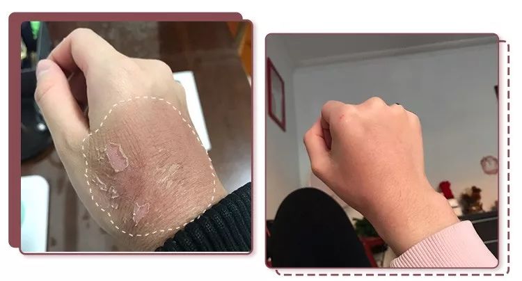 蔡依林皮肤特护霜,蔡依林胶原蛋白粉保养皮肤