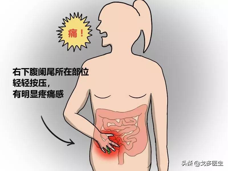 肚子疼真的那么简单吗？——慢性腹痛的一点点点的事