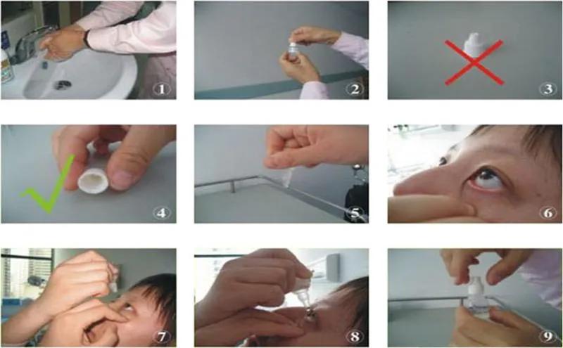 眼用半固体制剂有哪些,眼用制剂的正确使用方法