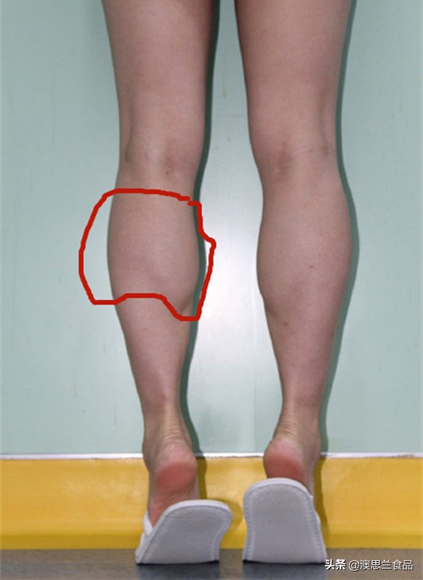小腿肌胖怎么瘦腿,大腿肥胖小腿粗壮怎么改善