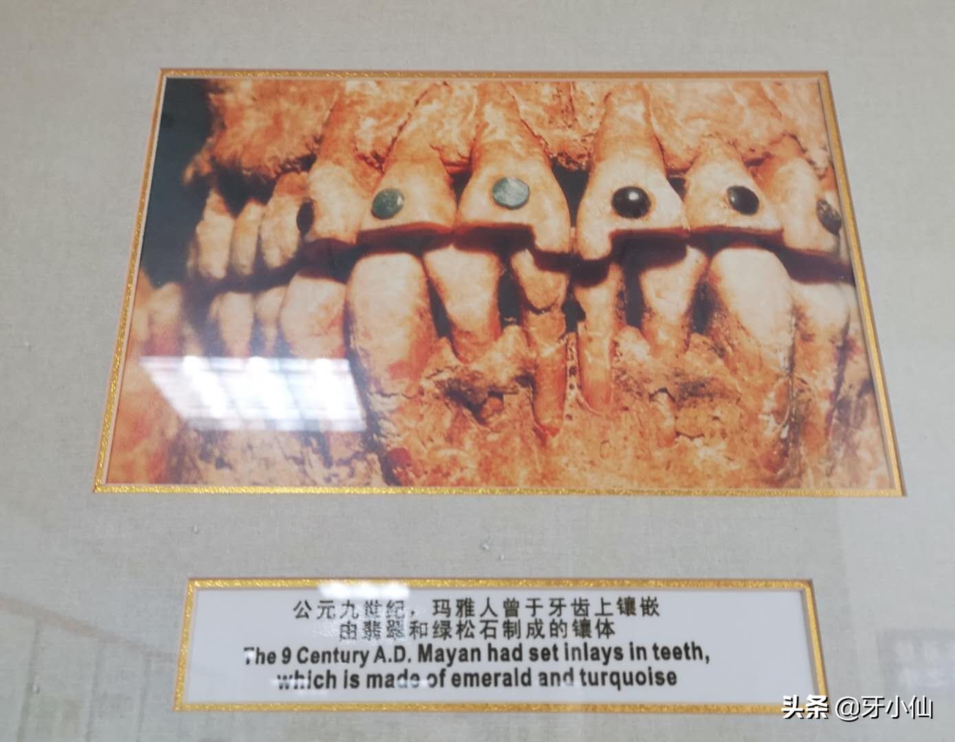 牙龈出血口臭跟牙齿不贴合,有个牙齿晃动牙龈出血口臭