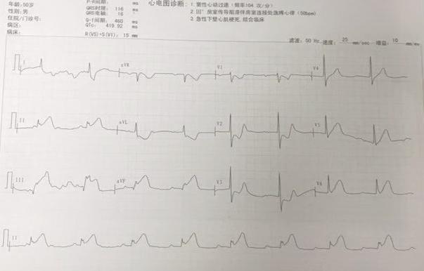 开始肩背痛现在手痛,胸肩背痛是怎么回事