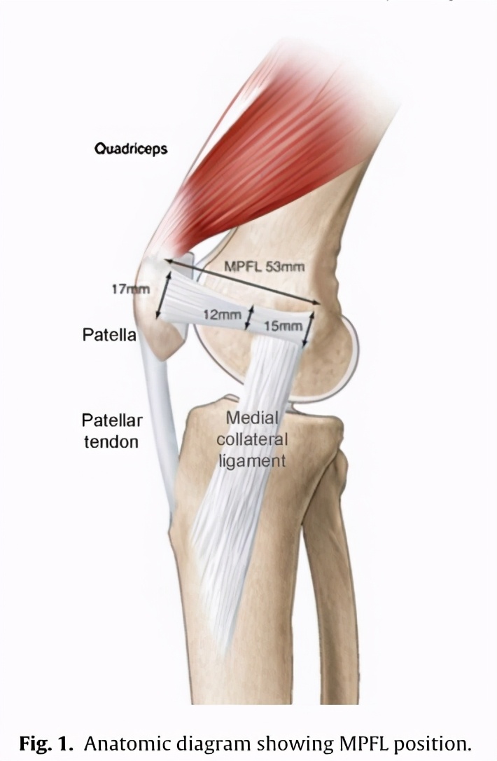 髌骨半脱位打石膏能彻底治愈吗,青少年髌骨脱位还能长高吗
