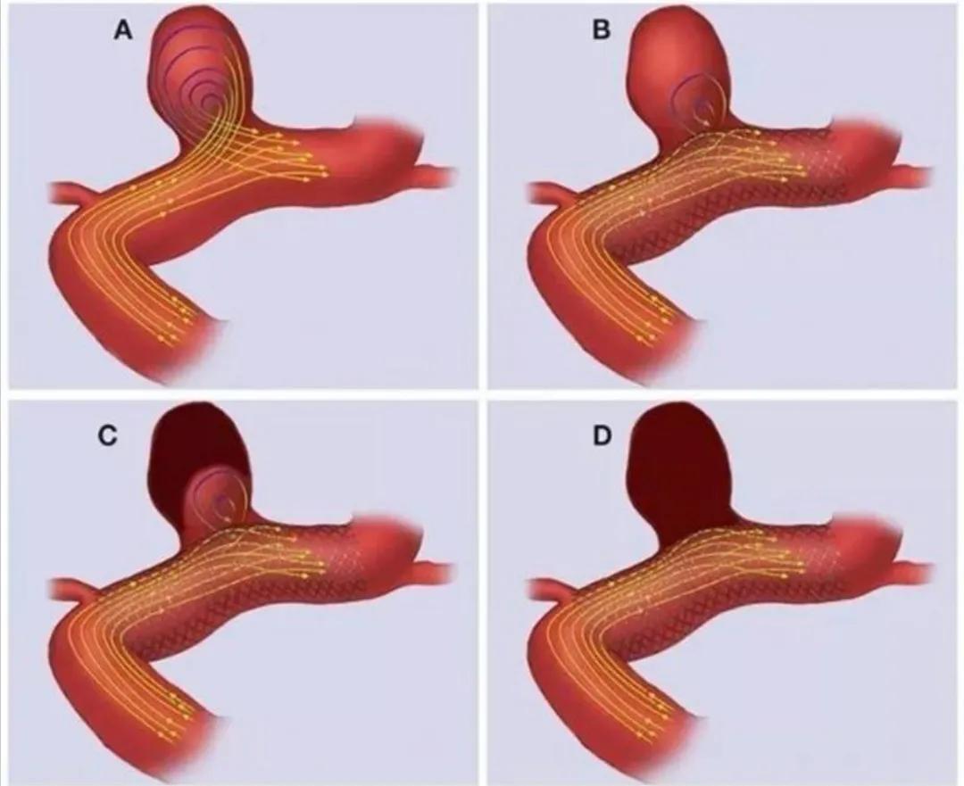 我为群众办实事两癌筛查,天津治疗颅内动脉瘤的医院