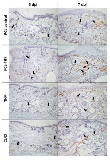 抗菌电纺百里酚负载聚己内酯垫的体内效应研究