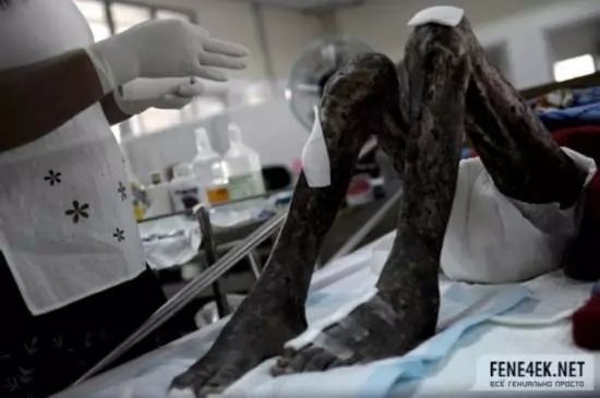 这里租妻合法，艾滋指数全球第一，每年竟还有3000万人要去