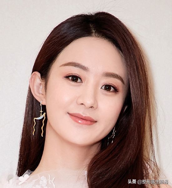 西安哪家双眼皮做的好,西安医美整形双眼皮