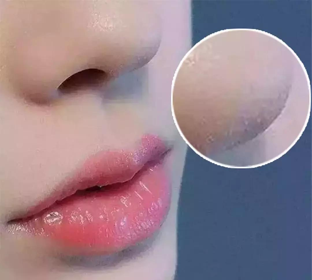 什么肤质适合刷酸美白,什么肤质适合刷酸