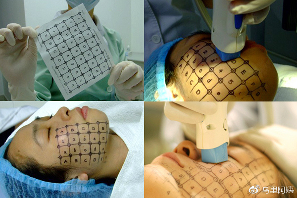 热玛吉机子的真伪怎么辨别,热玛吉5代怎么辨真伪