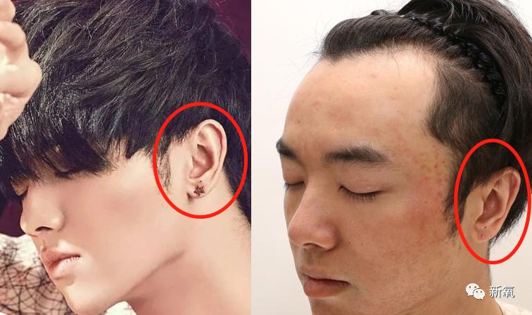 华晨宇整前整后对比,华晨宇最近又整脸了么