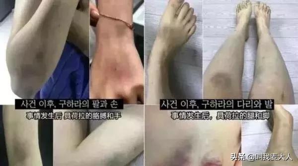 具荷拉今天出殡，她曾被家暴至子宫出血：我再也假装不下去了……