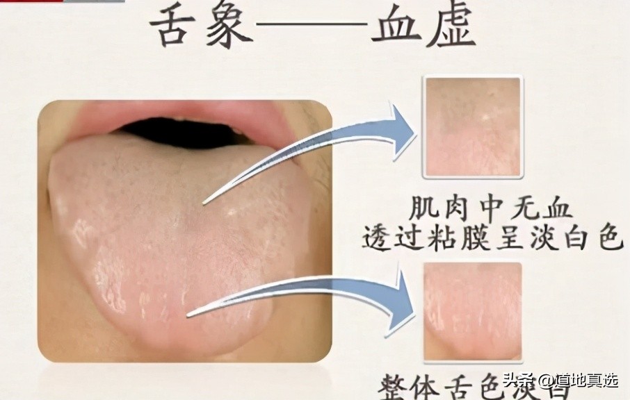 珍贵的舌诊图谱，看舌头知健康，人手一份！你也能快速识别疾病