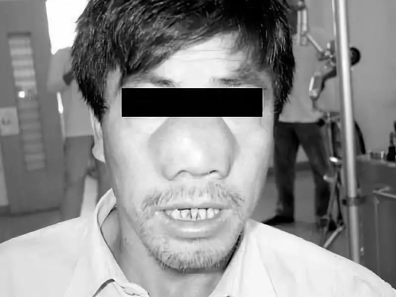 科普鼻息肉怎么形成的有什么危害,鼻息肉不治疗有什么危害