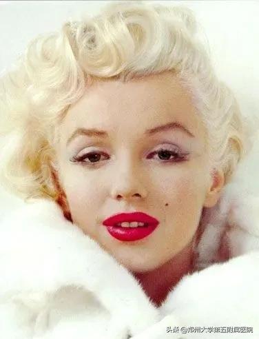 点痣那点事儿,激光点痣视频