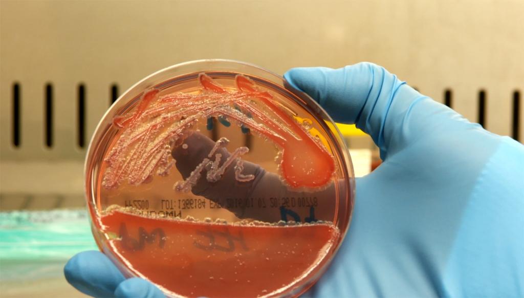 美国出现多起类鼻疽确诊病例，追踪溯源，目标再指德特里克堡