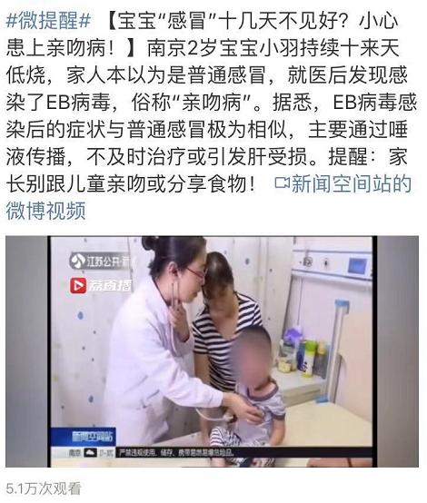 三岁小孩被确诊为亲吻病,2岁宝宝被亲吻高烧