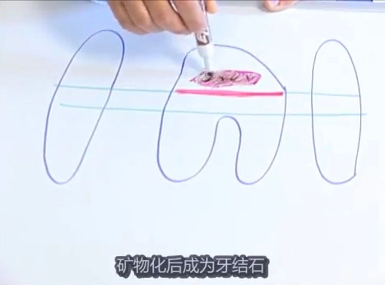 猫有牙周炎该怎么治疗,猫有牙龈炎怎么治疗