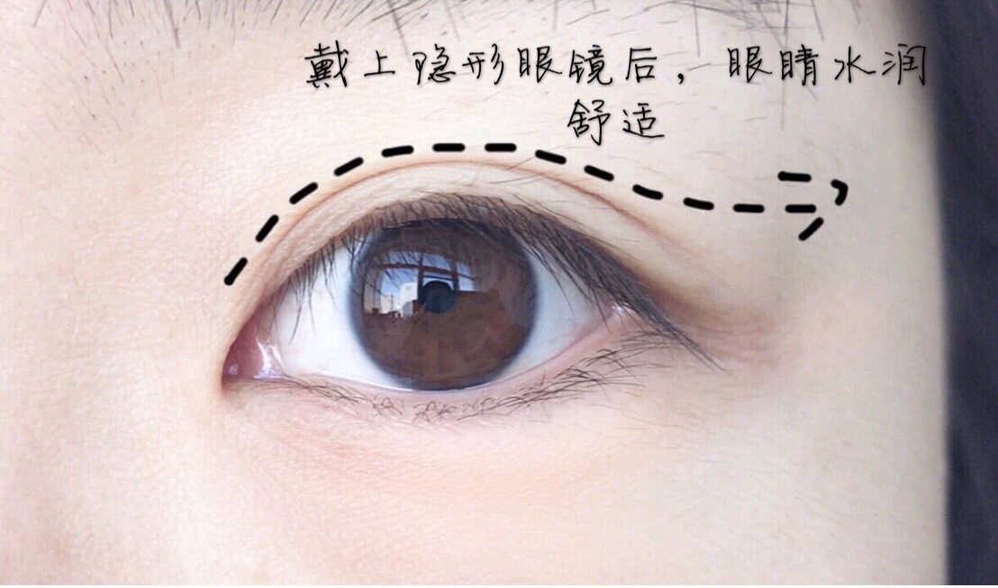 强生安视优恒润氧日抛隐形眼镜,安视优恒润氧是日抛的吗