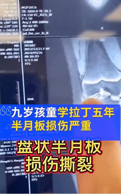 高位截瘫小孩10岁康复训练,小孩高位截瘫功能锻炼