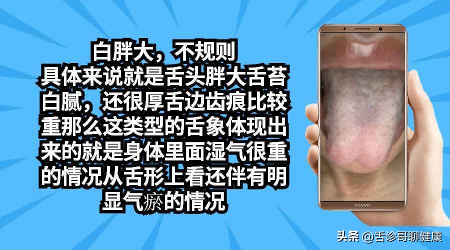 舌诊哥聊血瘀,舌诊哥聊健康痰湿