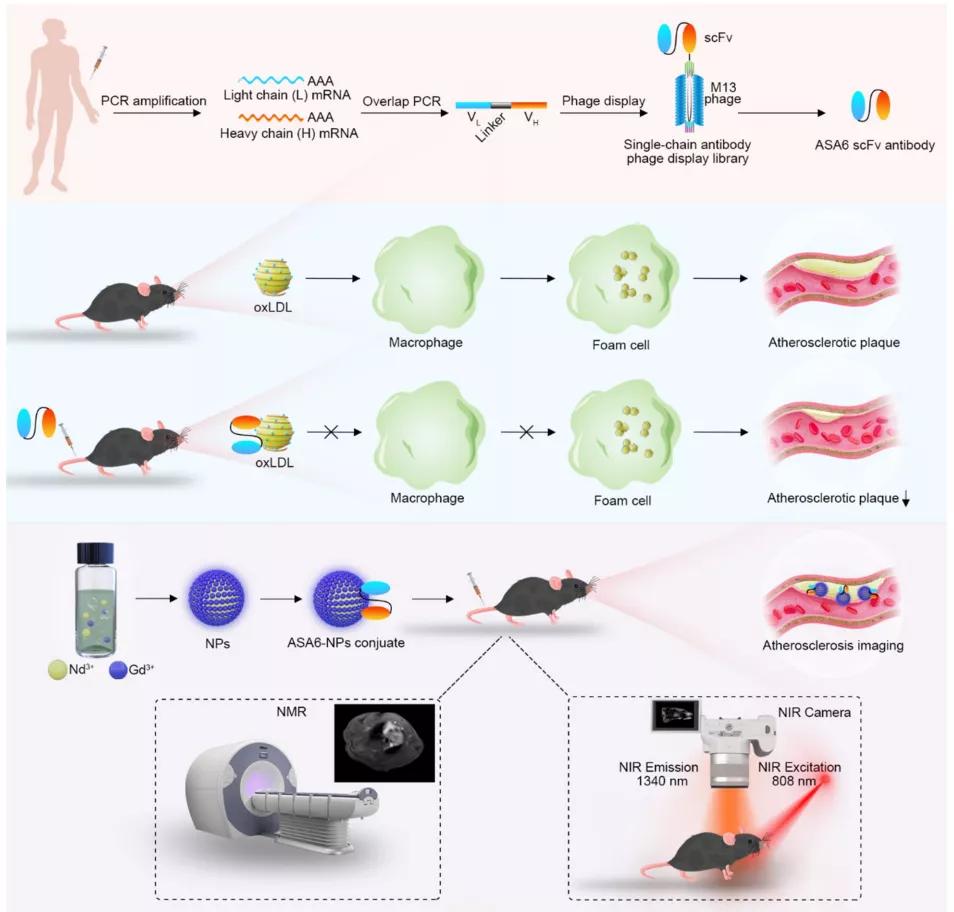 动脉粥样硬化靶向特效药,动脉粥样硬化最新药物研究