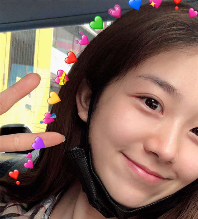 闭口和闭口粉刺,脸上长痘痘闭口粉刺引起的原因