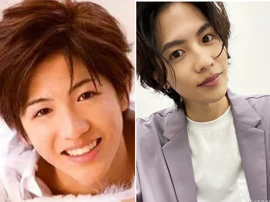 日本整容惊人案例,日本整容是不是最先进