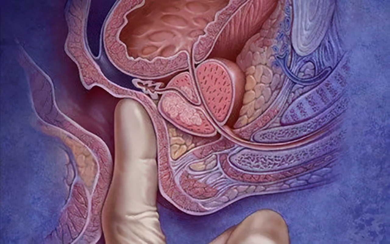 所有的肠癌都是由肠息肉演变的吗,所有肠癌都是肠息肉发展来的吗