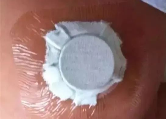 宝宝肚脐鼓起一个大包,宝宝肚脐鼓包