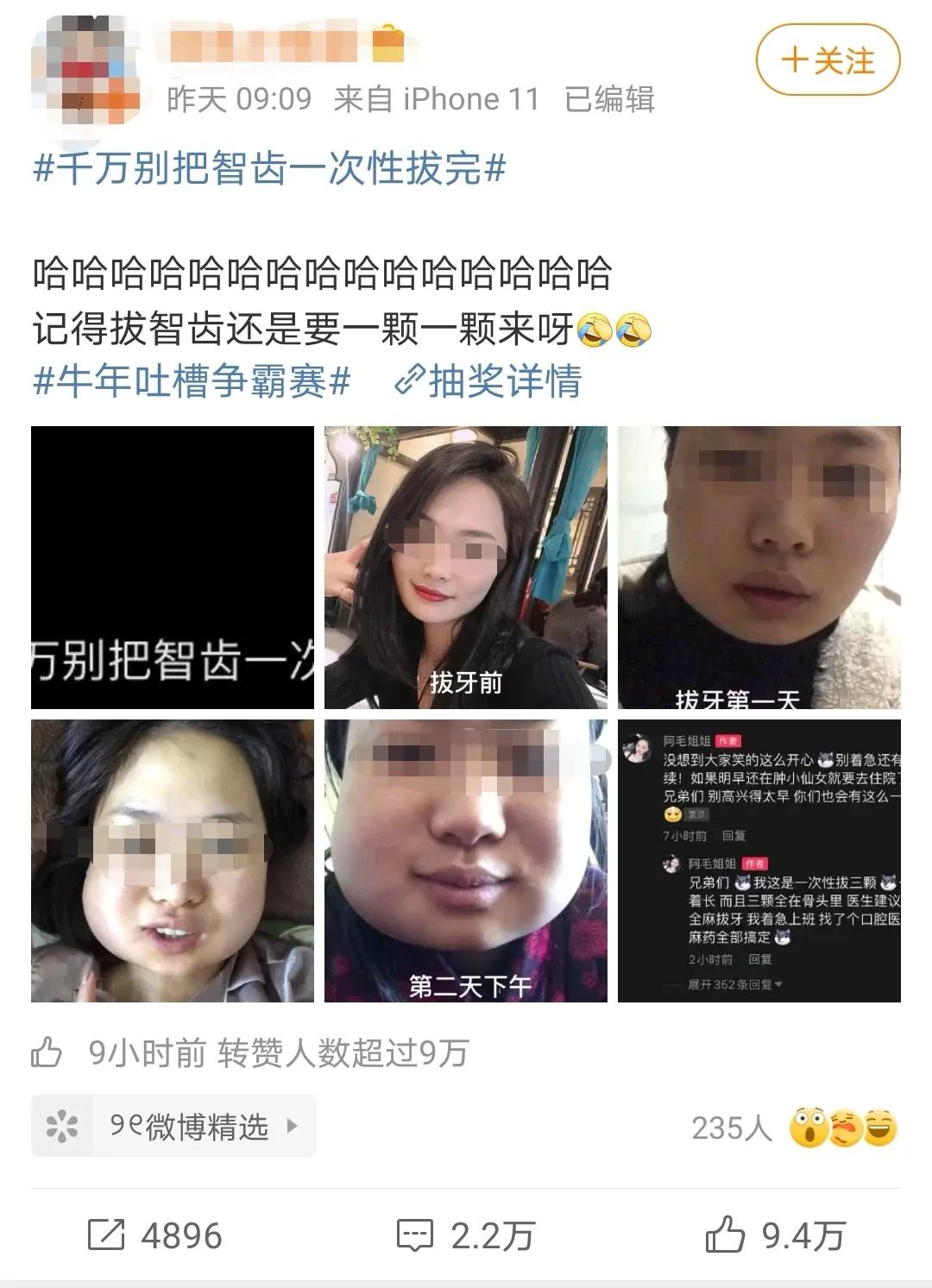 智齿一定要拔吗4种情况必拔,为什么不能把智齿一次性拔完