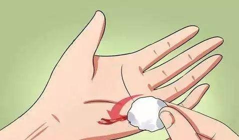 多少岁以后的疤很难愈合,为什么越长大伤口感觉愈合越慢