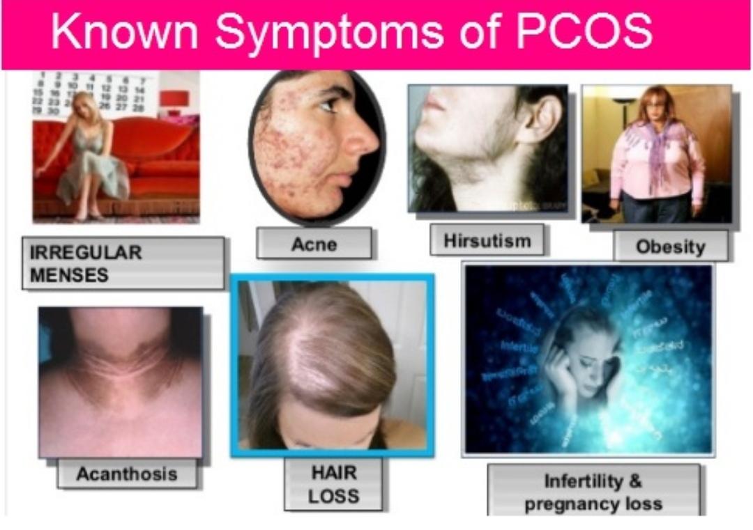 意大利女子牙龈长出睫毛状毛发，历经8年未治愈，病因很常见