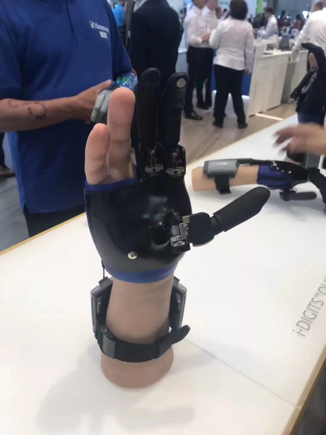 截肢后戴假肢老是疼怎么处理,截肢病人注意事项