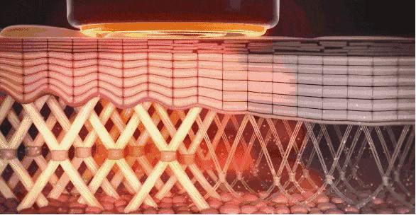 18岁脖子上有颈纹怎么按摩,18岁怎么去颈纹