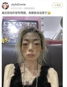 22岁嫁入豪门，结婚8年只剩44斤，嫩模伍智恒究竟经历了什么